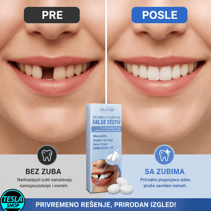 Privremeni zub – brzo rešenje za polomljen ili oštećen zub